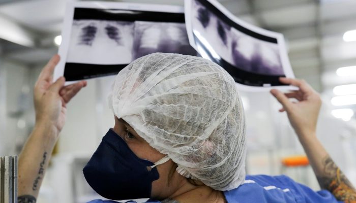 radiografia_de_torax_coronaviruscovid-19_hospital_sao_paulo1205200325.jpg